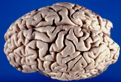 The human brain: left and right hemispheres